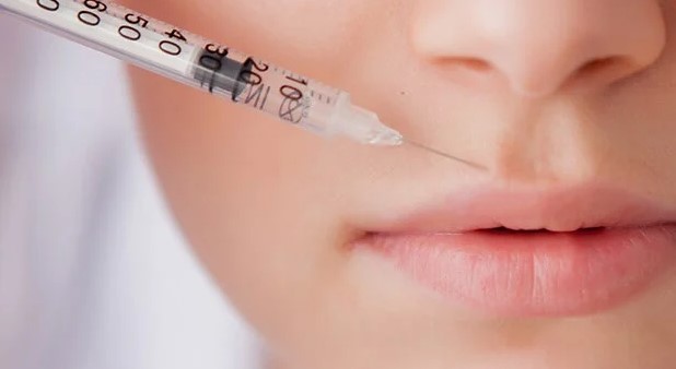 Where to Inject Botox for lip flip